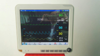 HM-2000E Medical Equipment 15 Inch Portable ECG Multi-parameter Patient Monitor