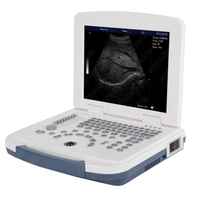 HBW-4 Full Digital Laptop B/W Ultrasound Scanner