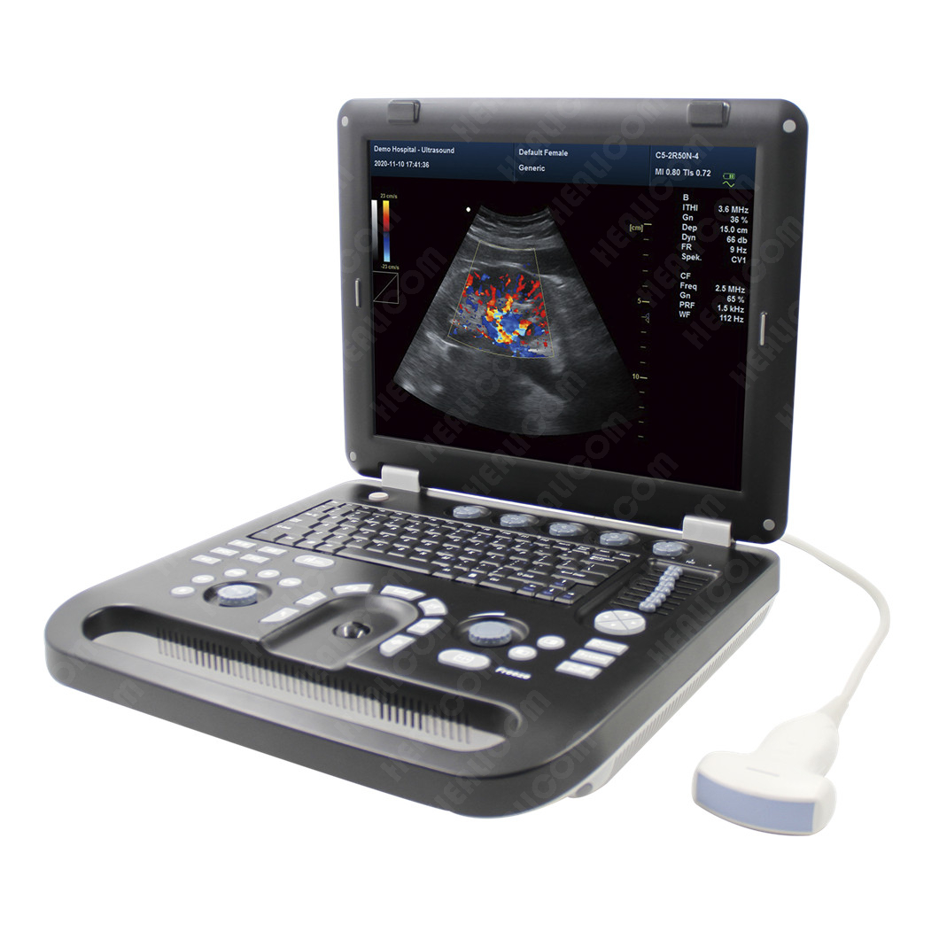 HUC-550/560/570 Laptop Color Doppler Ultrasound Scanner 
