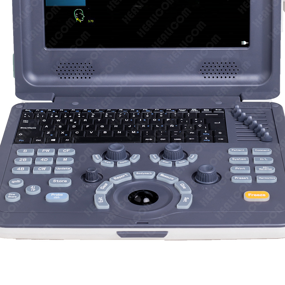 HUC-260 Portable Color Doppler Ultrasound Scanner 