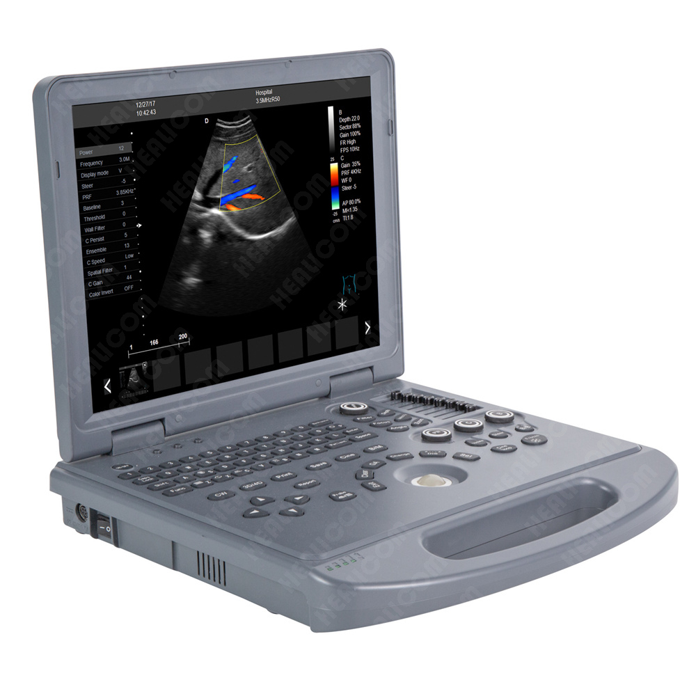 HUC-200 Laptop Color Doppler Ultrasound Scanner 